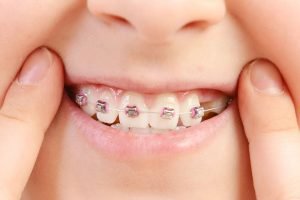 Clínica Dental Sevilla | Especialistas en ortodoncia infantil