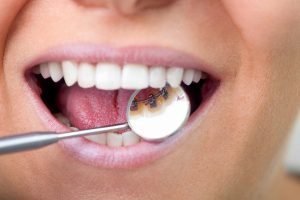 Clínica Dental Sevilla | Especialistas en ortodoncia lingual